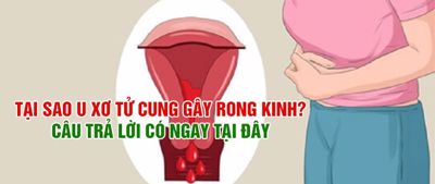 Tại sao u xơ tử cung gây rong kinh? Câu trả lời có ngay tại đây!